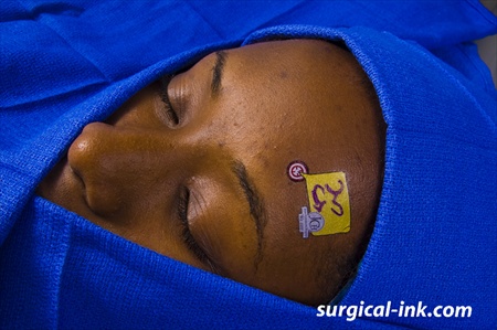 surgical-ink.com