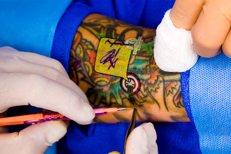 surgical-ink.com